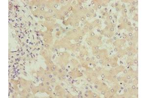 Immunohistochemistry of paraffin-embedded human liver tissue using ABIN7149960 at dilution of 1:100 (FMO4 Antikörper  (AA 1-300))