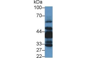 Western Blot; Sample: Human Lung lysate; Primary Ab: 1µg/ml Rabbit Anti-Human LIMS1 Antibody Second Ab: 0. (LIMS1 Antikörper  (AA 68-303))