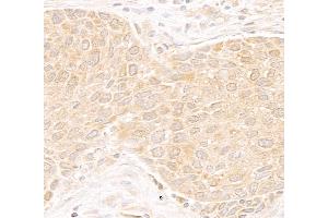 Immunohistochemistry (IHC) image for anti-DEAD (Asp-Glu-Ala-As) Box Polypeptide 19B (DDX19B) (C-Term) antibody (ABIN7453856)