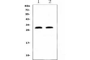 Western blot analysis of C Reactive Protein using anti-C Reactive Protein antibody (ABIN5692861).
