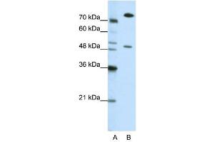 SSB antibody used at 0. (SSB Antikörper)