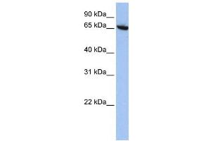 Western Blotting (WB) image for anti-Core-binding Factor, Runt Domain, alpha Subunit 2, Translocated To, 2 (CBFA2T2) (N-Term) antibody (ABIN2780644)