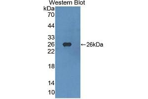 Western blot analysis of the recombinant protein. (FGFR4 Antikörper  (AA 165-366))