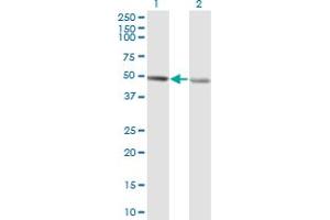 Western Blot analysis of RCC1 expression in transfected 293T cell line by RCC1 monoclonal antibody (M02), clone 1C1. (RCC1 Antikörper  (AA 312-421))