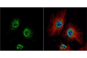 ICC/IF Image ZWINT antibody detects ZWINT protein at nucleus by immunofluorescent analysis.
