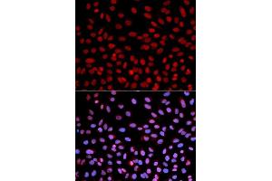 Immunofluorescence analysis of U2OS cells using POLH antibody. (POLH Antikörper  (AA 20-320))
