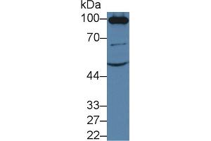 Western Blot; Sample: Mouse Kidney lysate; Primary Ab: 3µg/ml Rabbit Anti-Mouse ACE2 Antibody Second Ab: 0. (ACE2 Antikörper  (AA 93-464))