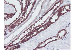 Immunohistochemical staining of paraffin-embedded Human Kidney tissue using anti-KIF2C mouse monoclonal antibody.