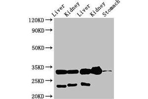 Western Blot Positive WB detected in: Rat liver tissue, Rat kidney tissue, Mouse liver tissue, Mouse kidney tissue, Mouse stomach tissue All lanes: TPSB2 antibody at 3 μg/mL Secondary Goat polyclonal to rabbit IgG at 1/50000 dilution Predicted band size: 31 kDa Observed band size: 31 kDa (TPSB2 Antikörper  (AA 31-275))
