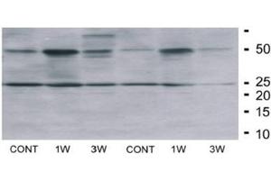 Fat Homogenates Stained by Irisin Antibody (FNDC5 Antikörper  (AA 42-112) (Magnetic Particles))