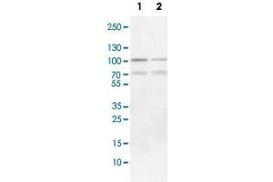 Western Blot analysis of Lane 1: NIH-3T3 cell lysate (mouse embryonic fibroblast cells) and Lane 2: NBT-II cell lysate (Wistar rat bladder tumor cells) with FOXP1 polyclonal antibody . (FOXP1 Antikörper)
