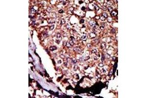 Image no. 2 for anti-Diacylglycerol Kinase, beta 90kDa (DGKB) (C-Term) antibody (ABIN360610) (DGKB Antikörper  (C-Term))