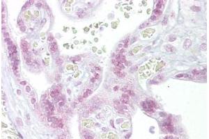 Anti-CHEK2 / CHK2 antibody IHC staining of human placenta. (CHEK2 Antikörper  (N-Term))