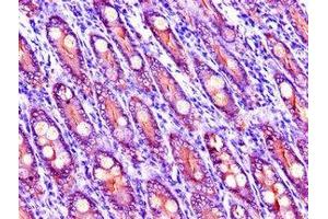 Immunohistochemistry of paraffin-embedded human small intestine tissue using ABIN7151743 at dilution of 1:100 (LIPG Antikörper  (AA 360-500))