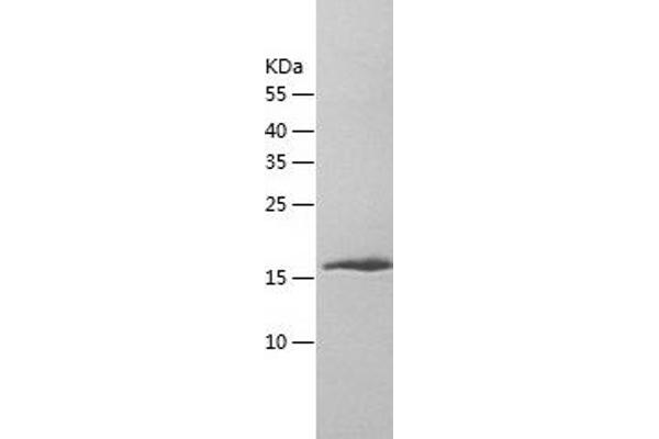 IZUMO1 Protein (AA 51-211) (His tag)