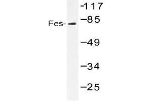 Western blot (WB) analysis of Fes antibody in extracts from HUVEC serum 20 (FES Antikörper)