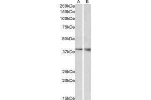 ABIN2560782 (1µg/ml) staining of Mouse Kidney (A) and Brain (B) lysate (35µg protein in RIPA buffer). (WNT9B Antikörper  (Internal Region))