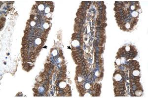 Human Intestine (PGRMC1 Antikörper  (N-Term))
