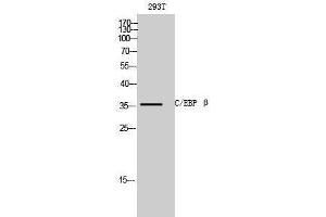 Western Blotting (WB) image for anti-CCAAT/enhancer Binding Protein (C/EBP), beta (CEBPB) (C-Term) antibody (ABIN3174088) (CEBPB Antikörper  (C-Term))