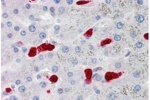Human Liver, Hepatocytes and Macrophages (formalin-fixed, paraffin-embedded) stained with S100A8 antibody ABIN334264 at 5 ug/ml followed by biotinylated anti-mouse IgG secondary antibody ABIN481714, alkaline phosphatase-streptavidin and chromogen. (S100A8 Antikörper)