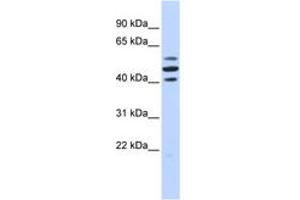 Image no. 1 for anti-HSPB (Heat Shock 27kDa) Associated Protein 1 (HSPBAP1) (AA 180-229) antibody (ABIN6742394) (HSPBAP1 Antikörper  (AA 180-229))