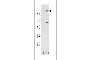 Western blot analysis of PIK3R5 using rabbit polyclonal PIK3R5 Antibody using 293 cell lysates (2 ug/lane) either nontransfected (Lane 1) or transiently transfected with the PIK3R5 gene (Lane 2). (PIK3R5 Antikörper  (AA 392-421))
