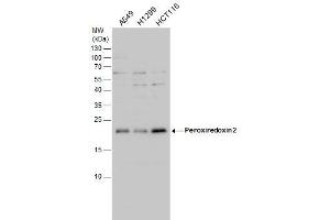 WB Image Peroxiredoxin 2 antibody detects Peroxiredoxin 2 protein by western blot analysis. (Peroxiredoxin 2 Antikörper)
