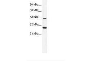 PREB anticorps  (AA 140-189)
