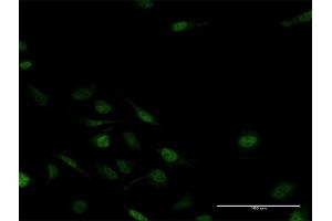 Immunofluorescence of purified MaxPab antibody to MSX2 on HeLa cell. (Msx2/Hox8 Antikörper  (AA 1-267))