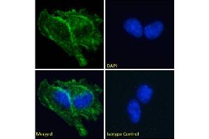 Immunofluorescence staining of fixed U251 cells with anti-Prion antibody 3F4. (Rekombinanter PRNP Antikörper)