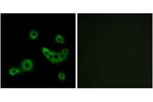 Immunofluorescence analysis of MCF7 cells, using PEVR2 Antibody. (PEVR2 (AA 235-284) Antikörper)