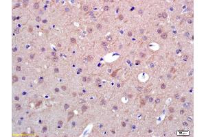 Formalin-fixed and paraffin embedded rat brain labeled with Anti-PAPOA Polyclonal Antibody, Unconjugated (ABIN1714857) at 1:200 followed by conjugation to the secondary antibody and DAB staining. (PAPOLA Antikörper  (AA 601-700))