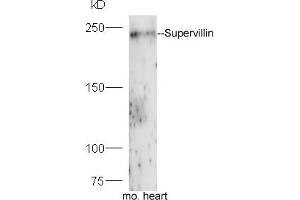 Mouse heart lysates probed with Rabbit Anti-Supervillin Polyclonal Antibody, Unconjugated (ABIN1714235) at 1:300 overnight at 4 °C.