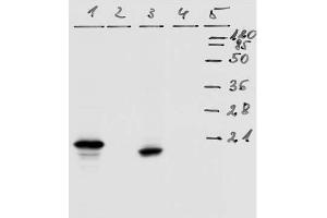 Western-Blot analysis of HPV-18 E7 protein. (HPV18 E7 Antikörper  (AA 36-70))