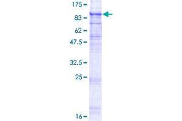 TMEM8A Protein (AA 1-771) (GST tag)