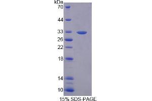Image no. 1 for Tenascin XB (TNXB) (AA 3824-4071) protein (His tag) (ABIN6238471) (TNXB Protein (AA 3824-4071) (His tag))