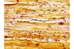Immunohistochemistry of paraffin-embedded human skeletal muscle tissue using ABIN7160161 at dilution of 1:100 (SLC16A12 Antikörper  (AA 431-486))