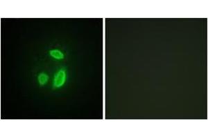 Immunofluorescence (IF) image for anti-Extra Spindle Poles Like 1 (ESPL1) (AA 767-816) antibody (ABIN2879105) (Separase Antikörper  (AA 767-816))
