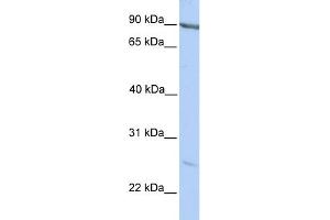 WB Suggested Anti-MARCH2 Antibody Titration:  0. (MARCH2 Antikörper  (C-Term))