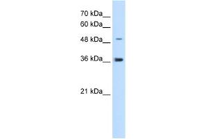 WB Suggested Anti-IRX1 Antibody Titration:  5. (IRX1 Antikörper  (N-Term))