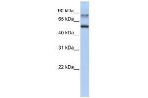 Epsin 1 antibody used at 1 ug/ml to detect target protein. (Epsin 1 Antikörper  (C-Term))