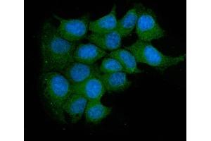 IF analysis of Acid Phosphatase/ACP5 using anti-Acid Phosphatase/ACP5 antibody (ABIN7601574). (ACP5 Antikörper  (AA 39-325))