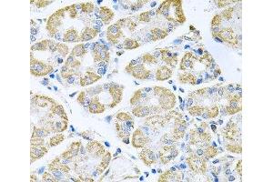 Immunohistochemistry of paraffin-embedded Human stomach using TNFRSF10A Polyclonal Antibody at dilution of 1:100 (40x lens). (TNFRSF10A Antikörper)