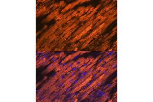 Immunofluorescence analysis of rat heart using HSP20/HSPB6 Rabbit mAb (ABIN7267592) at dilution of 1:100 (40x lens). (HSPB6 Antikörper)
