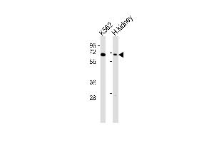 All lanes : Anti-Arylsulfatase D Antibody at 1:1000 dilution Lane 1: K562 whole cell lysates Lane 2: human kidney lysates Lysates/proteins at 20 μg per lane. (Arylsulfatase D Antikörper)