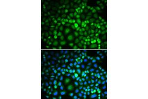 Immunofluorescence analysis of MCF-7 cells using RUVBL2 antibody. (RUVBL2 Antikörper  (AA 1-463))