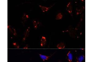 Immunofluorescence analysis of U-2 OS cells using TBRG4 Polyclonal Antibody at dilution of 1:100. (TBRG4 Antikörper)