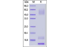 SDS-PAGE (SDS) image for Mucin 1 (MUC1) (AA 890-1158) protein (His tag,AVI tag,Biotin) (ABIN6951027)