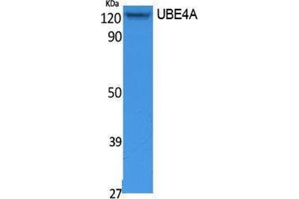 UBE4A antibody  (N-Term)
