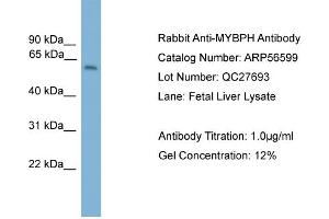 WB Suggested Anti-MYBPH  Antibody Titration: 0.